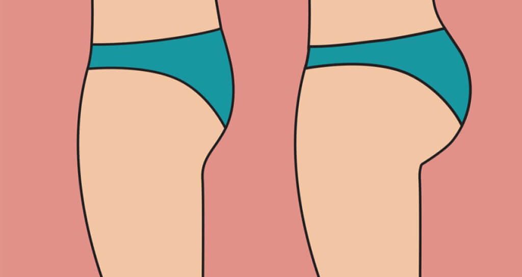 İstanbul Brezilya Popo Yapımı