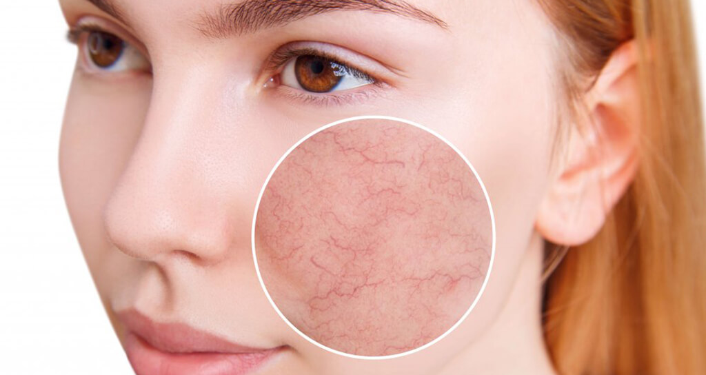 İstanbul Cilt Defektleri