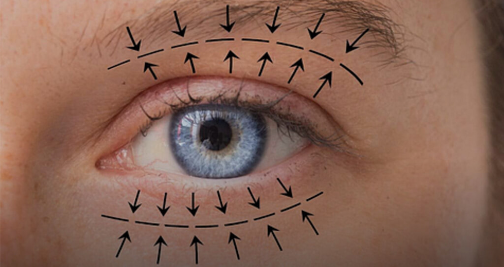 İstanbul Göz Kapağı Estetiği