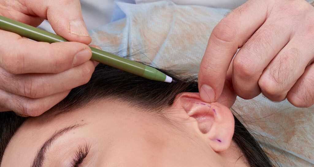 İstanbul Kepçe Kulak Ameliyatı