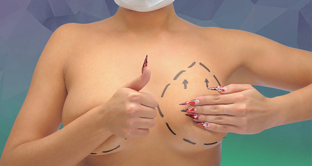 İstanbul Meme Dikleştirme Ameliyatı