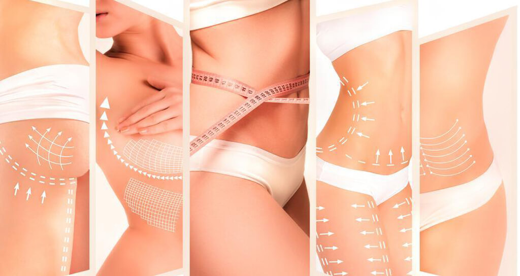 İstanbul Kilo Verme Sonrası Vücut Şekillendirme