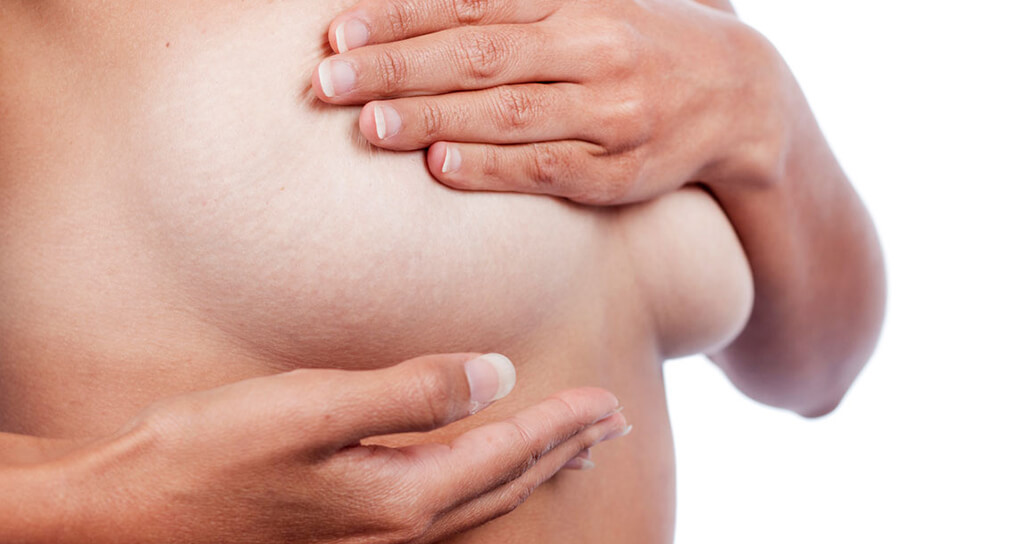 İstanbul Meme Rekonstrüksiyonu