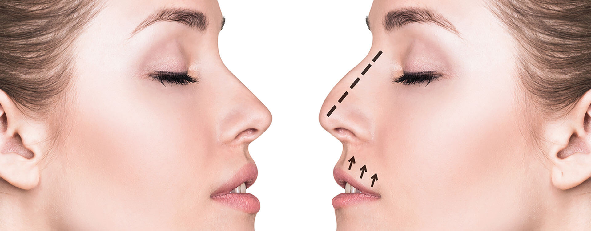 İstanbul Estetik Cerrah