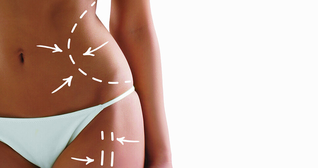 İstanbul Yağ Alma (Laser veya Vaser)