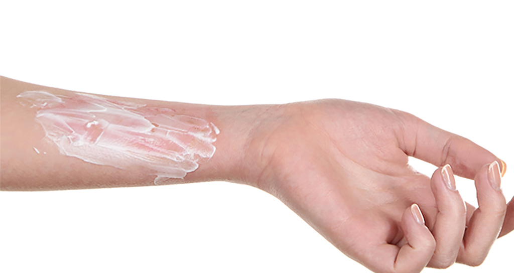 İstanbul Yanık Sekelleri