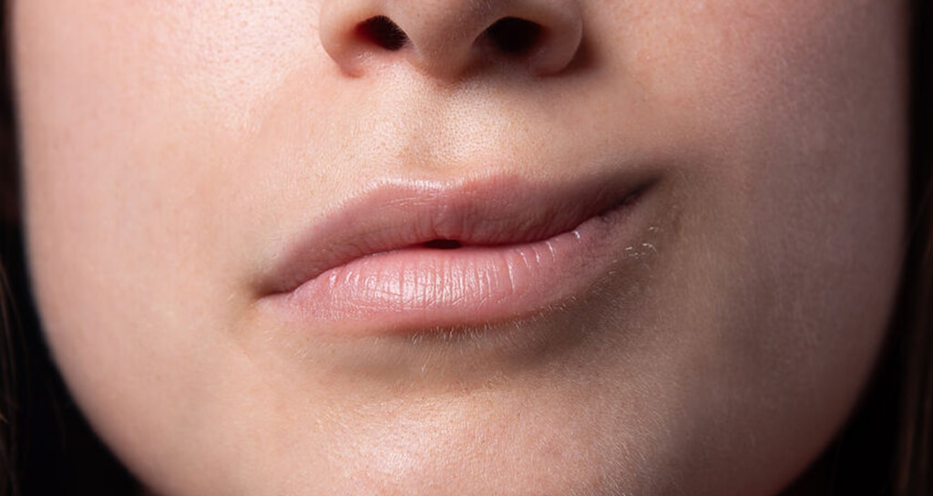 İstanbul Yüz Travmaları